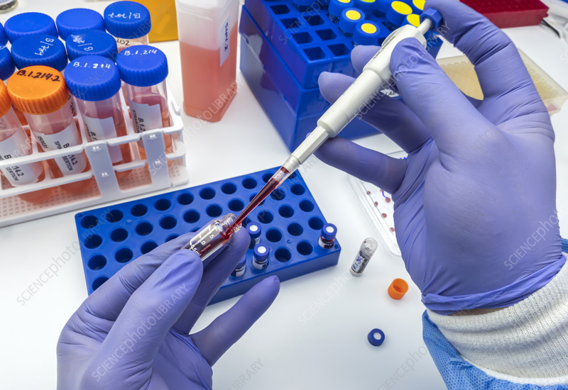 blood sample analysis