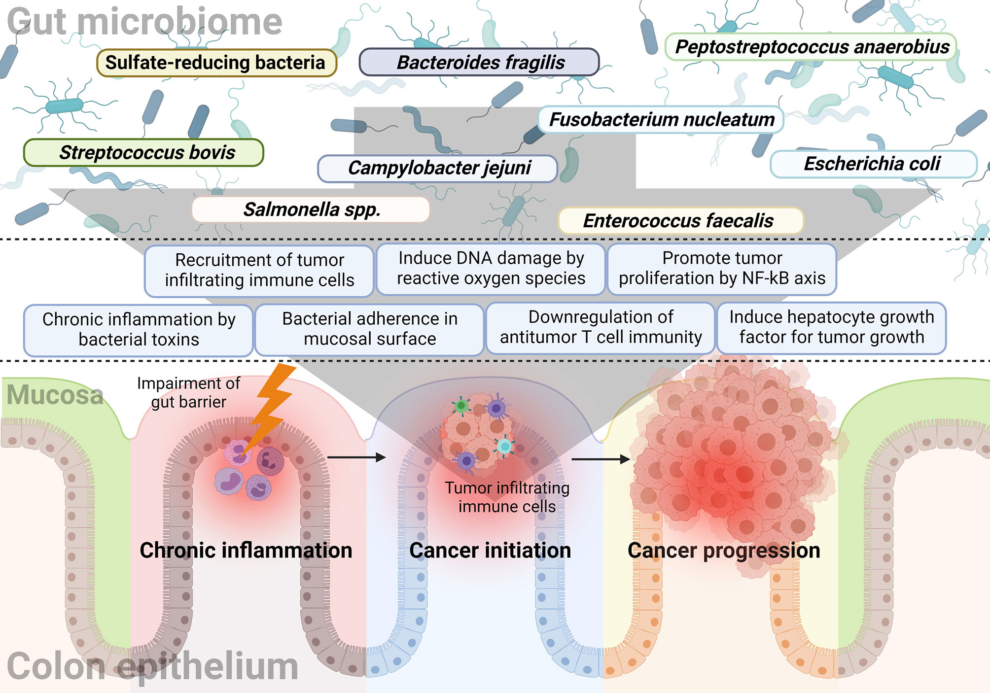 colorectal cancer microbiome theory