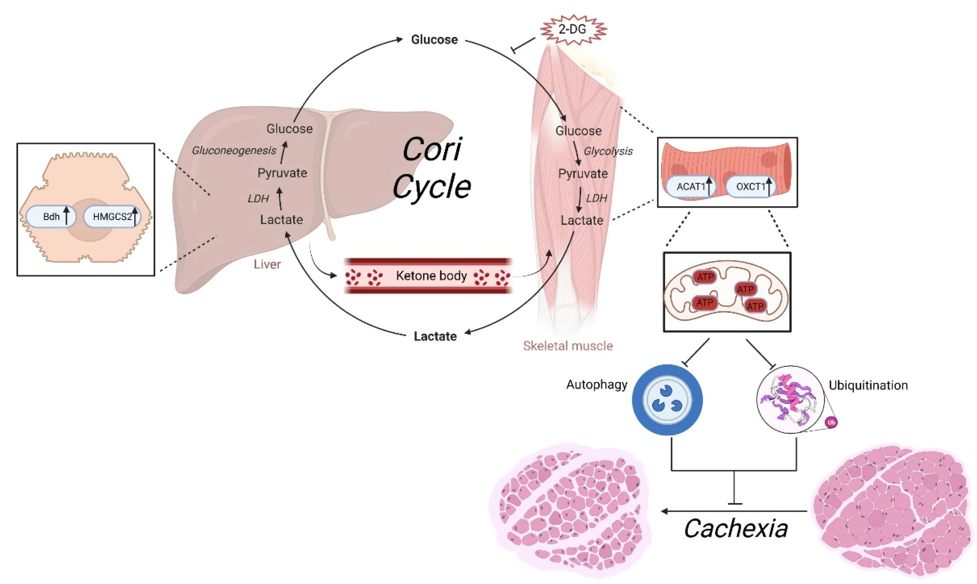 cancer cachexia muscle wasting