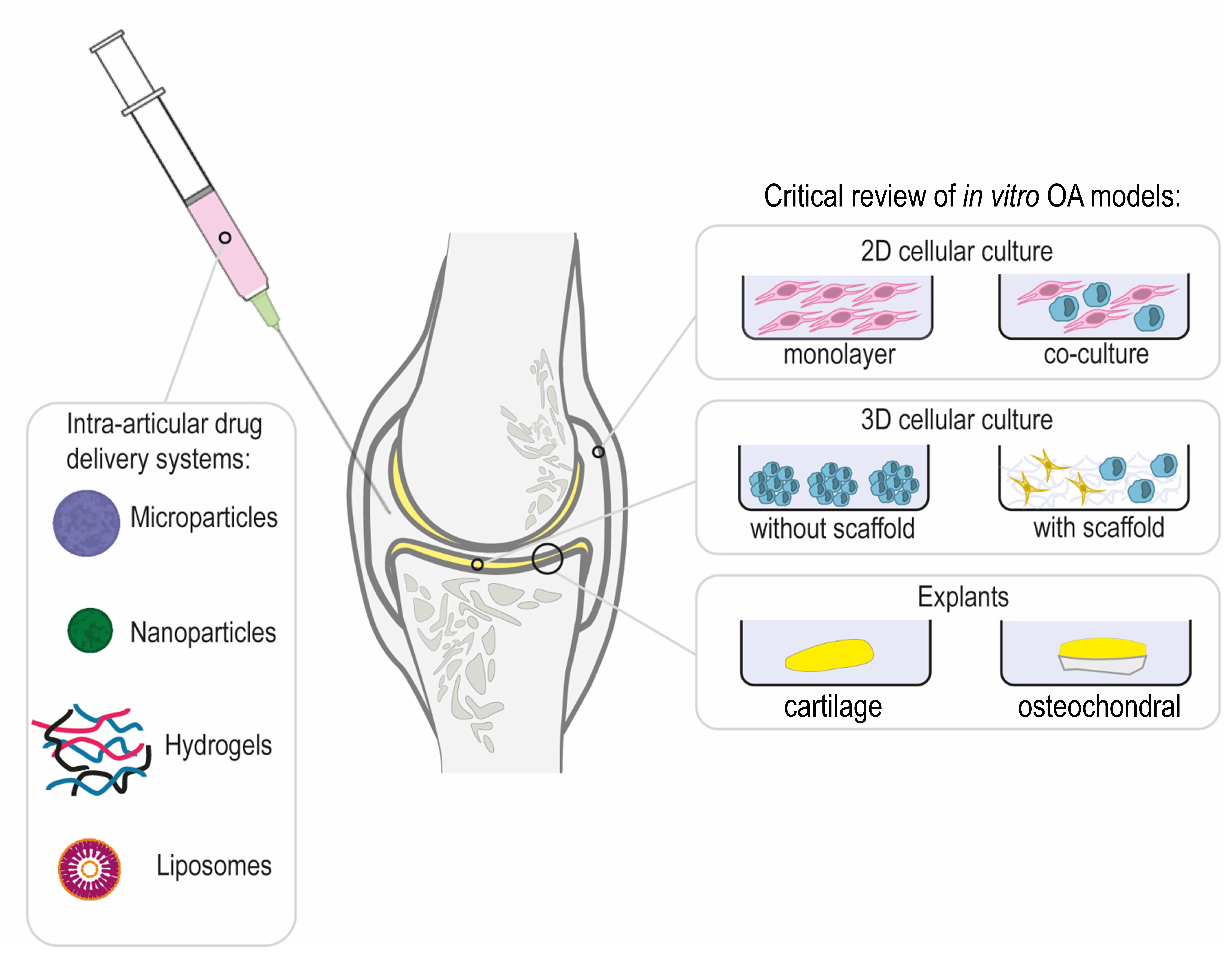 Epilepsy Drug Shows Promise to Reverse Osteoarthritis Damage