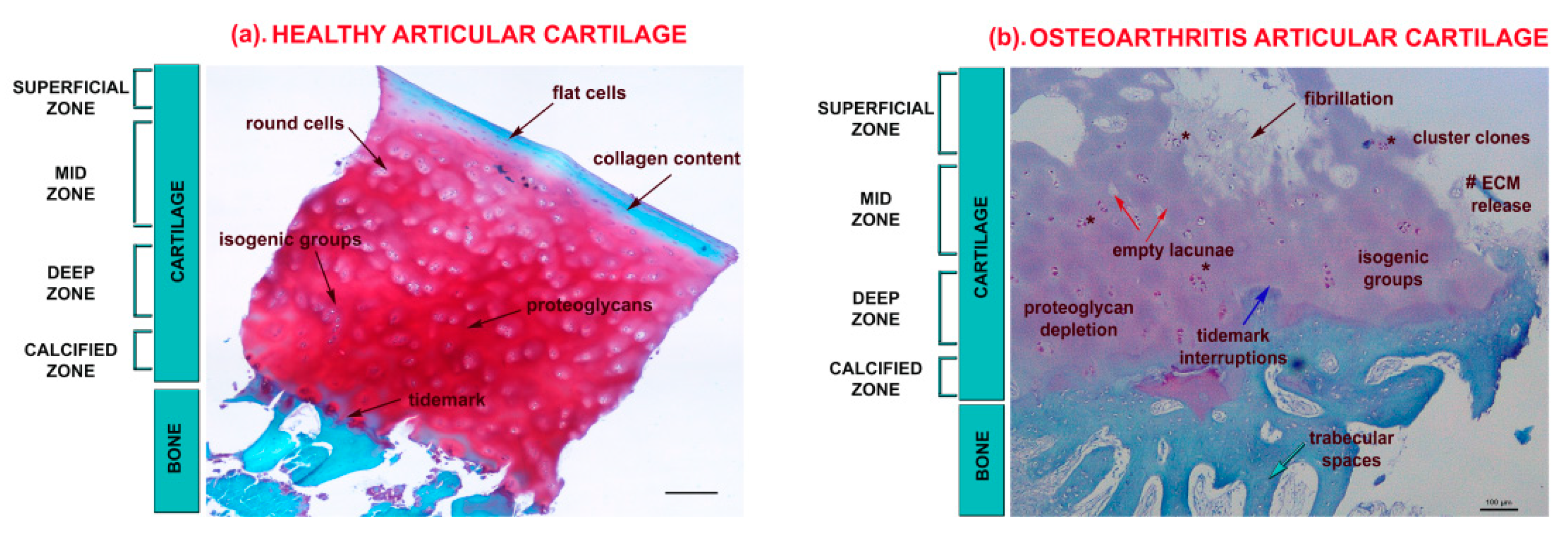 osteoarthritis cartilage laboratory microscope