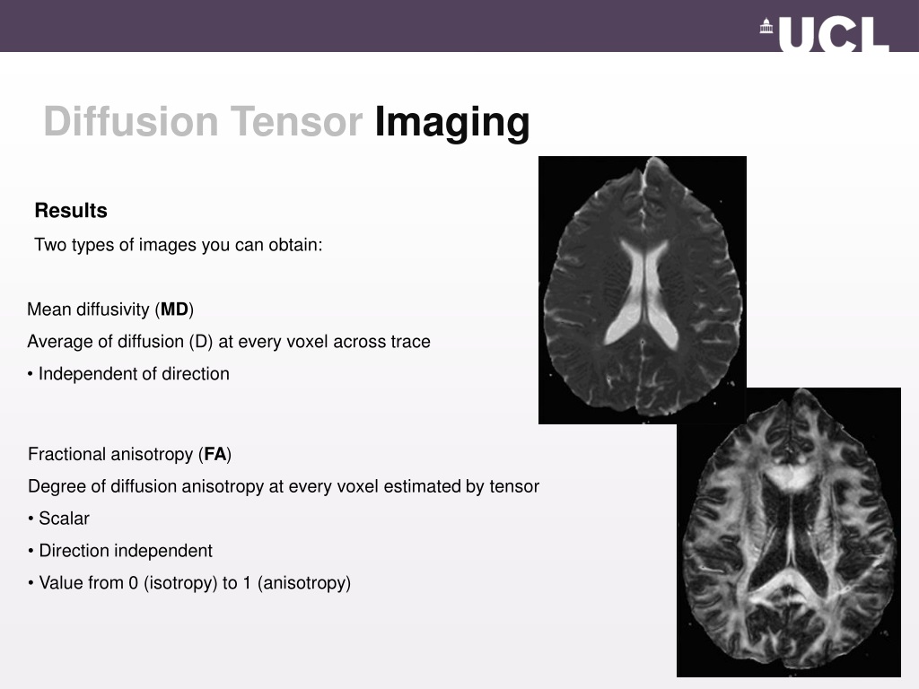 diffusion tensor imaging clitoris