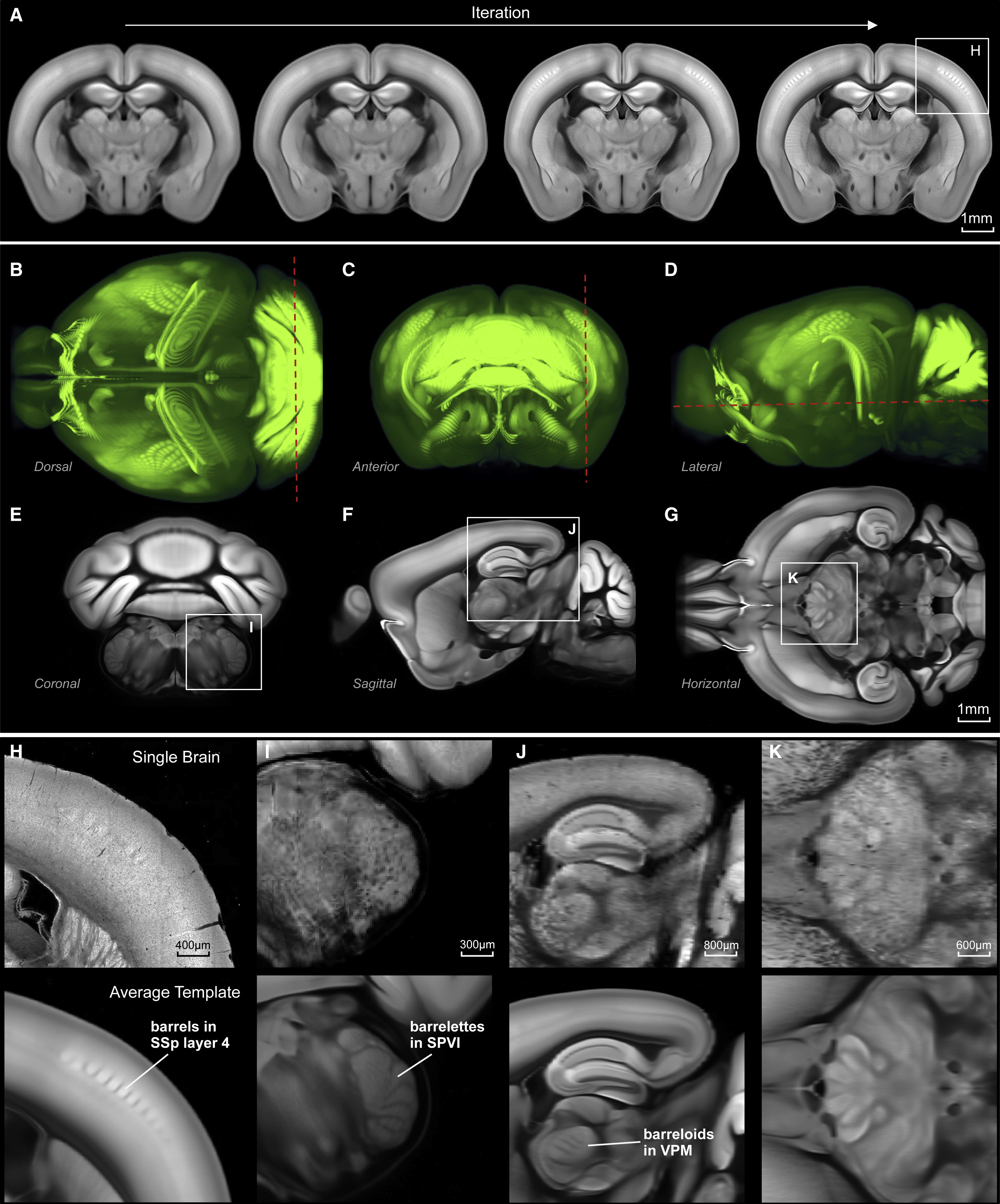 aged mouse brain anatomy