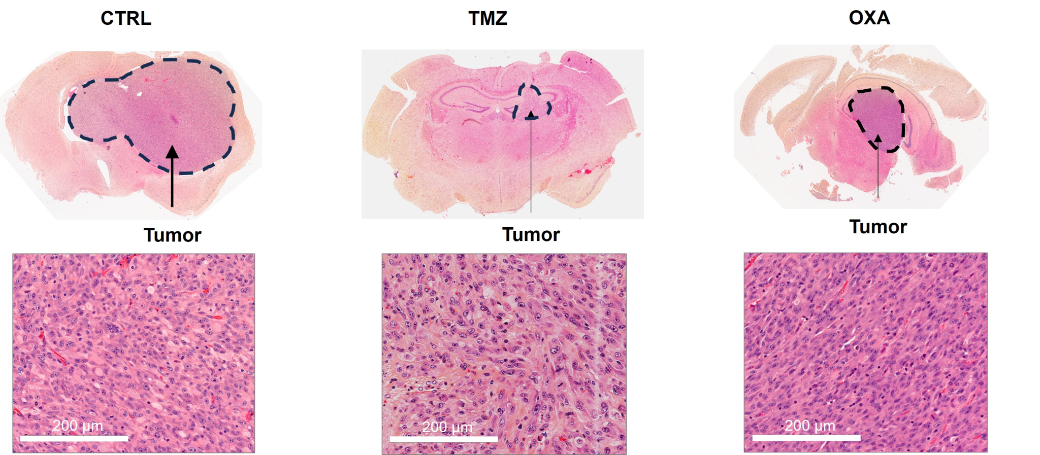 Glioblastoma laboratory research