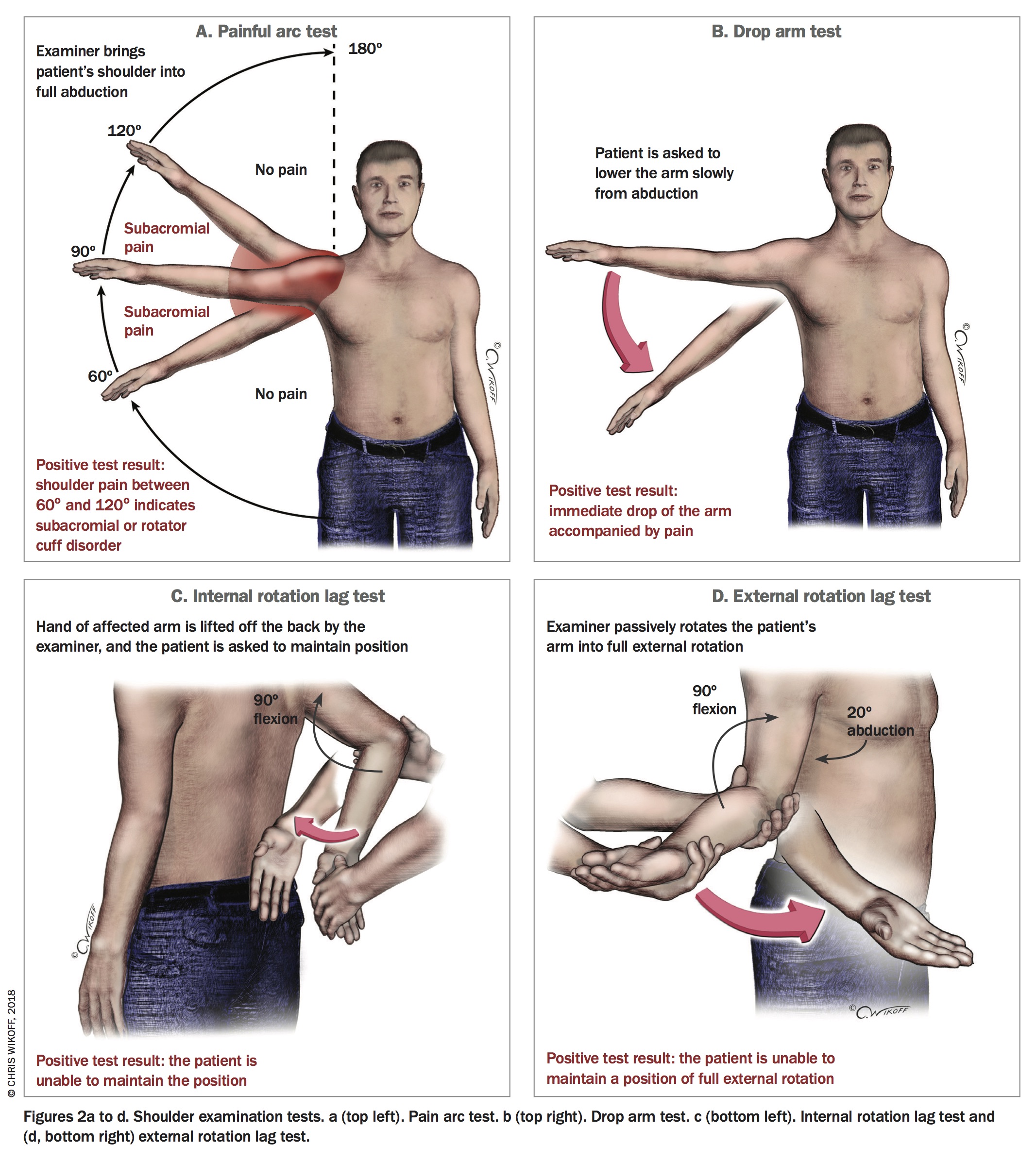 abduction signs physical indicators