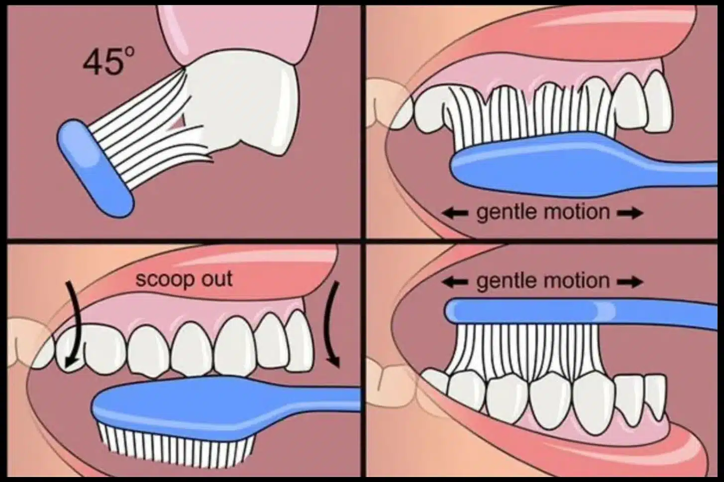 correct tooth brushing angle
