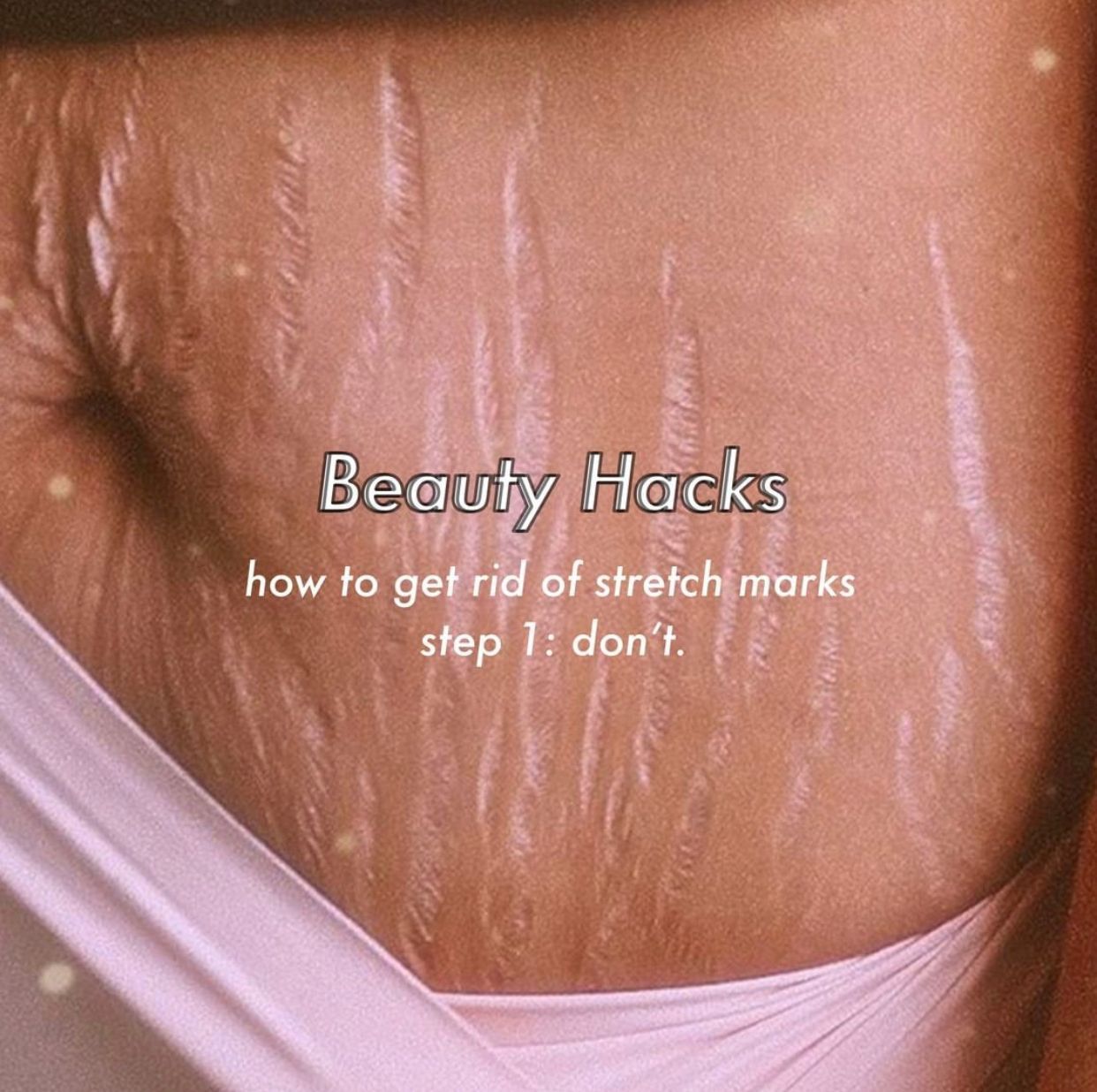 stretch marks body acceptance