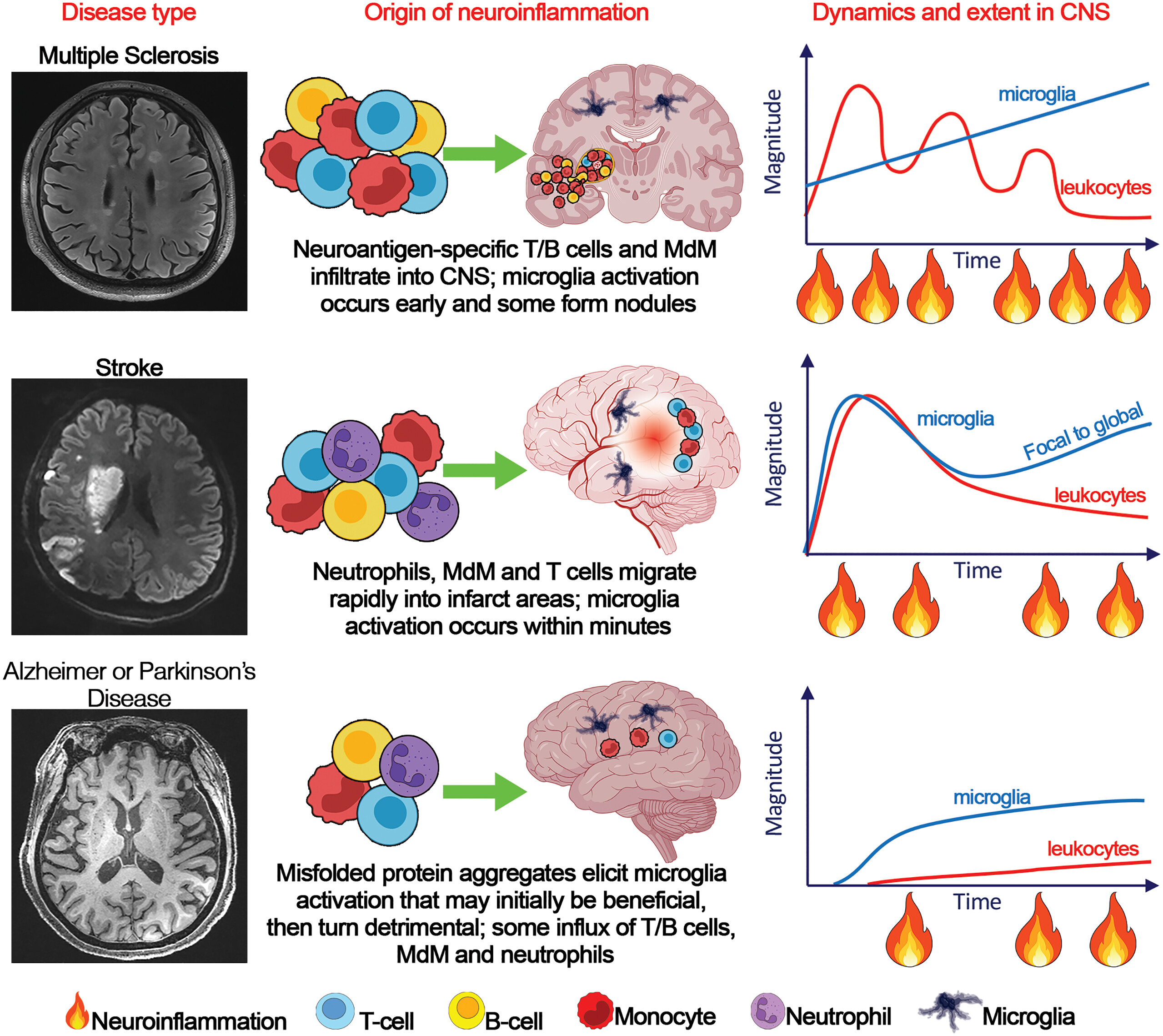human brain neuroinflammation illustration