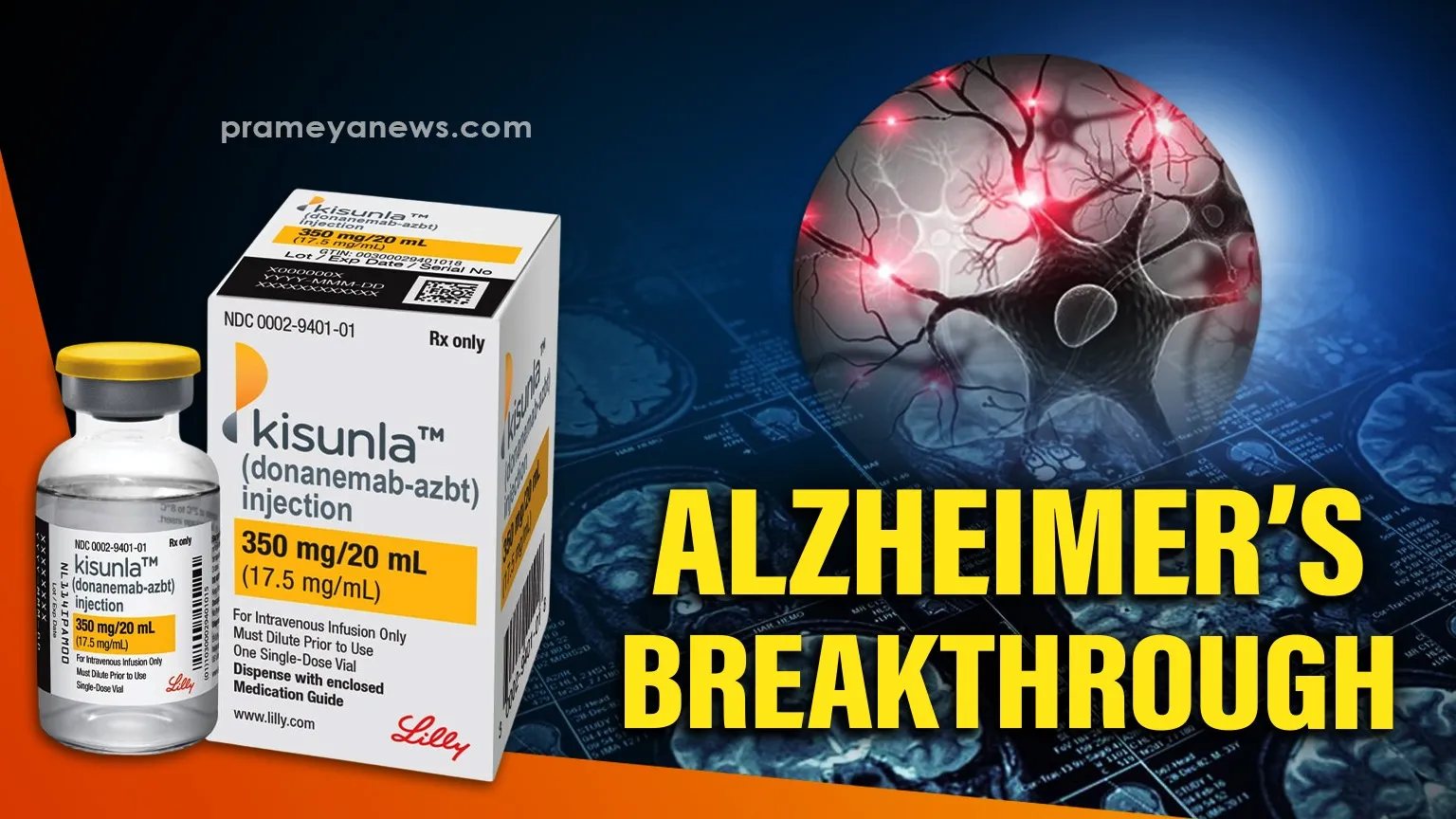 New Alzheimer’s Trigger Identified — Drug Blocks It in Early Tests