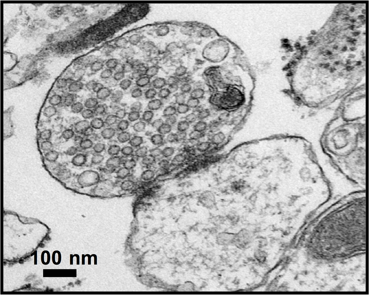 synapse loss microscopy imaging