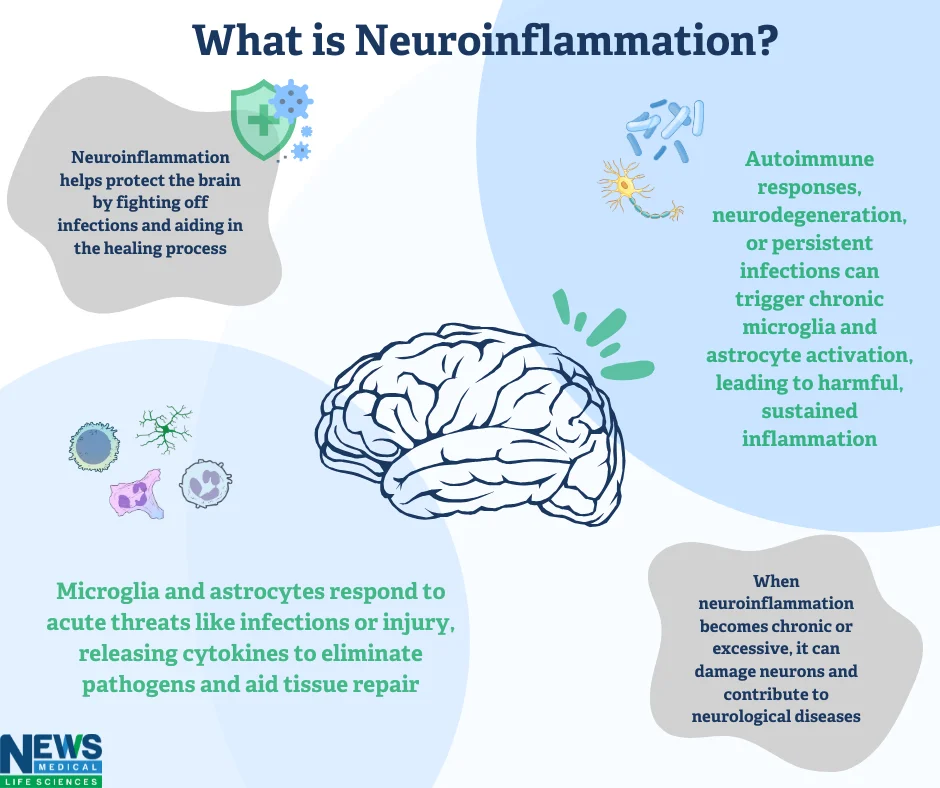 neuroinflammation brain immune cells
