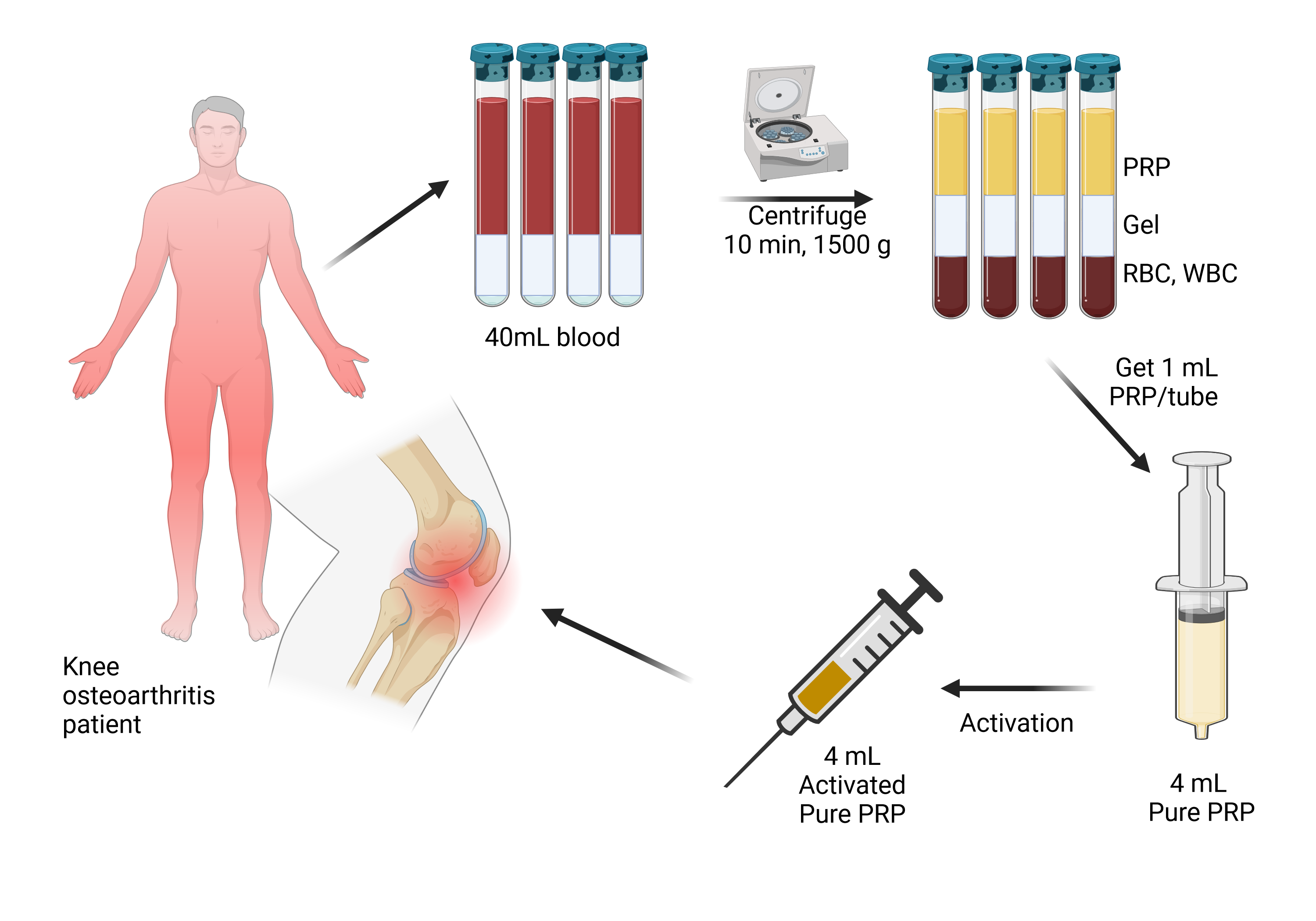platelet rich plasma knee injection