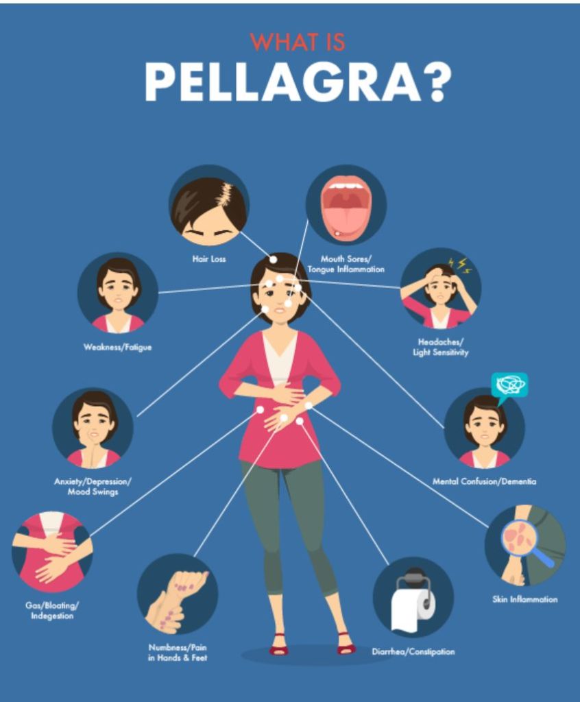 vitamin deficiency pellagra