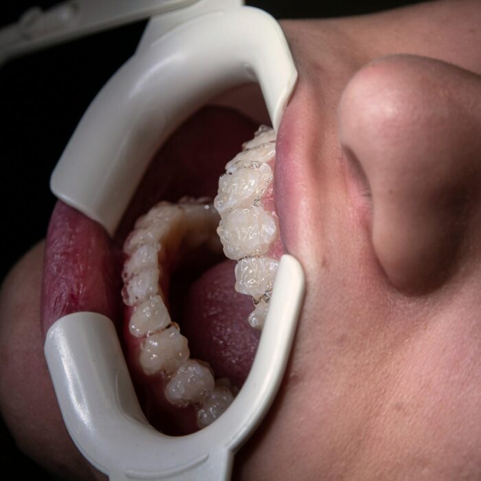 facial reconstruction surgery