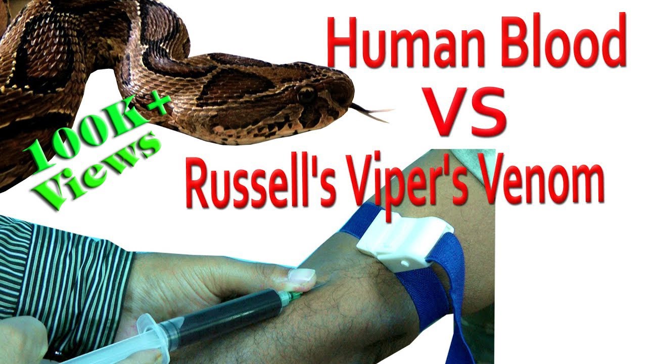 Russell’s Viper Venom: How It Destroys Human Blood