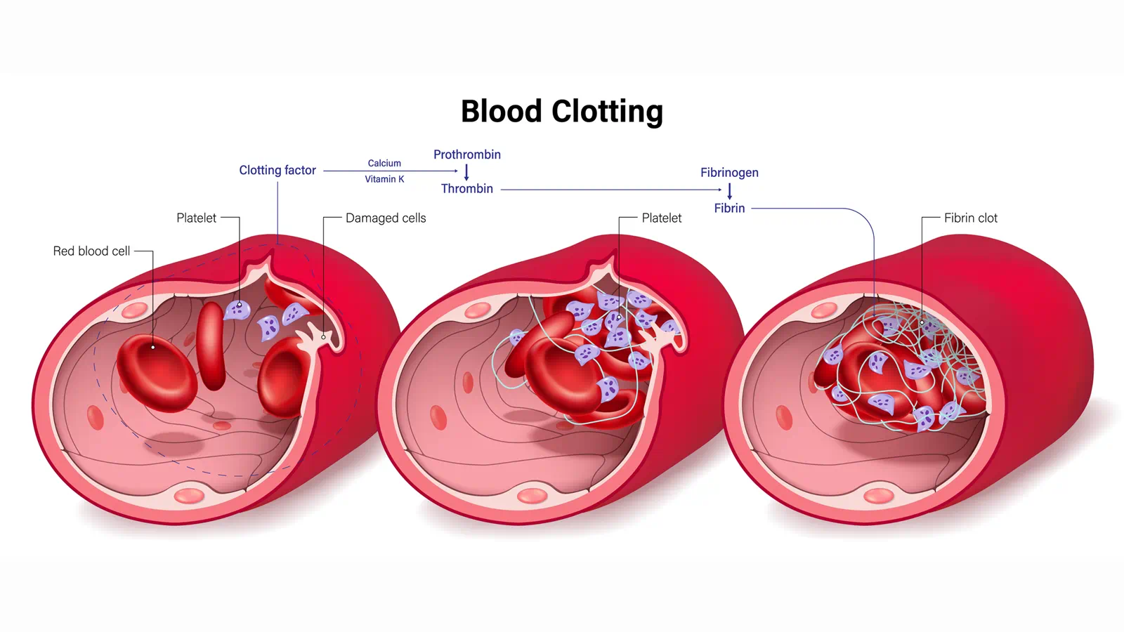 coagulation factors illustration