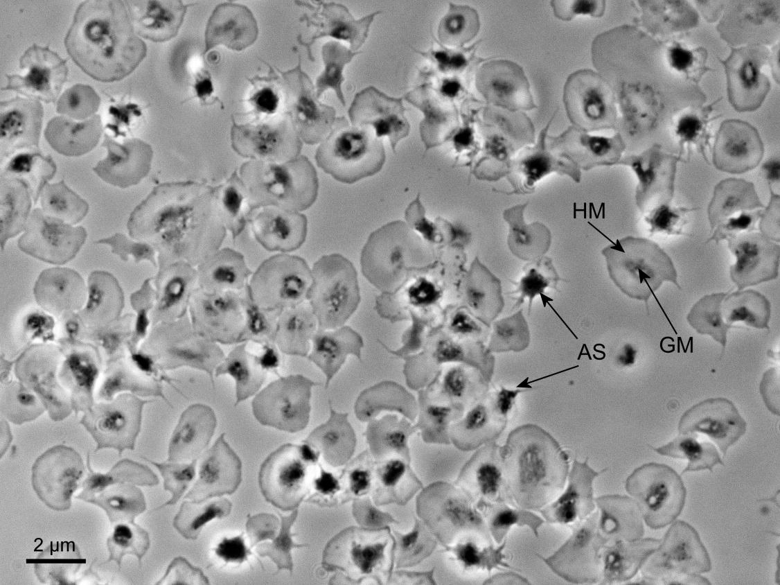 platelet aggregation microscopy