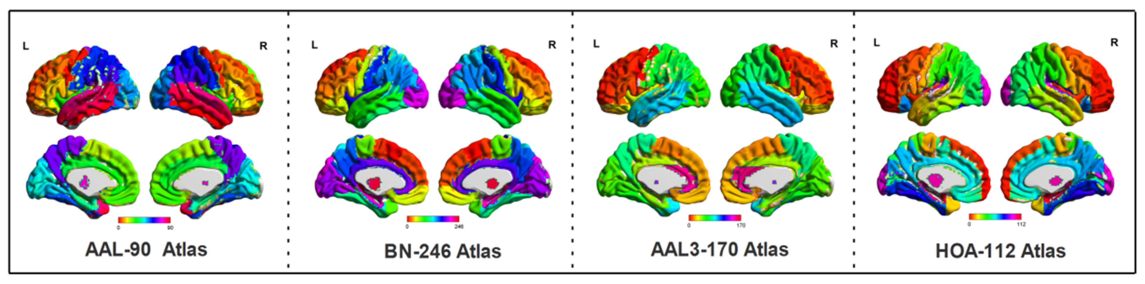Scientists Map 539 Distinct Brain Regions — New Atlas