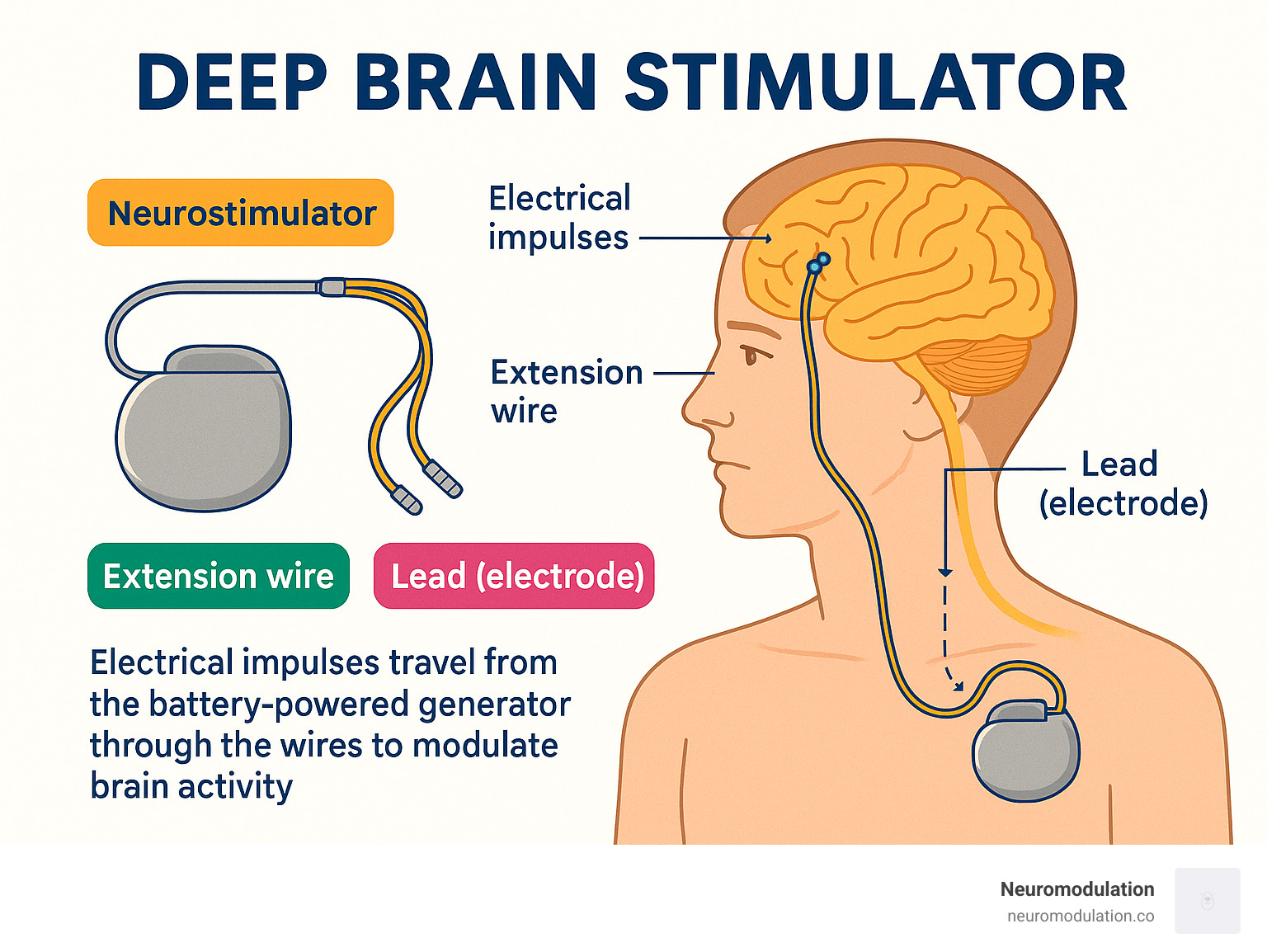 deep brain stimulation electrode anatomy