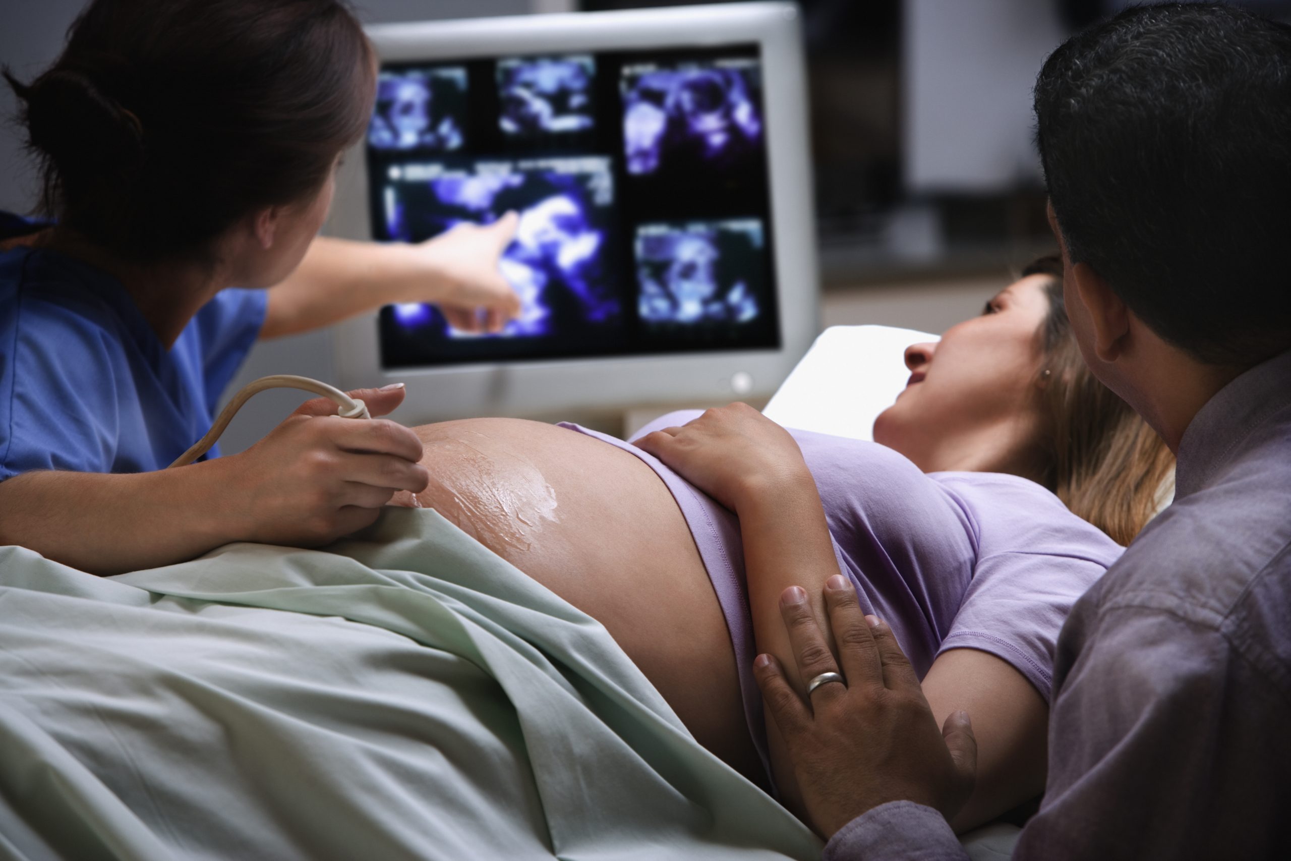 Prenatal ultrasound monitoring of a fetus