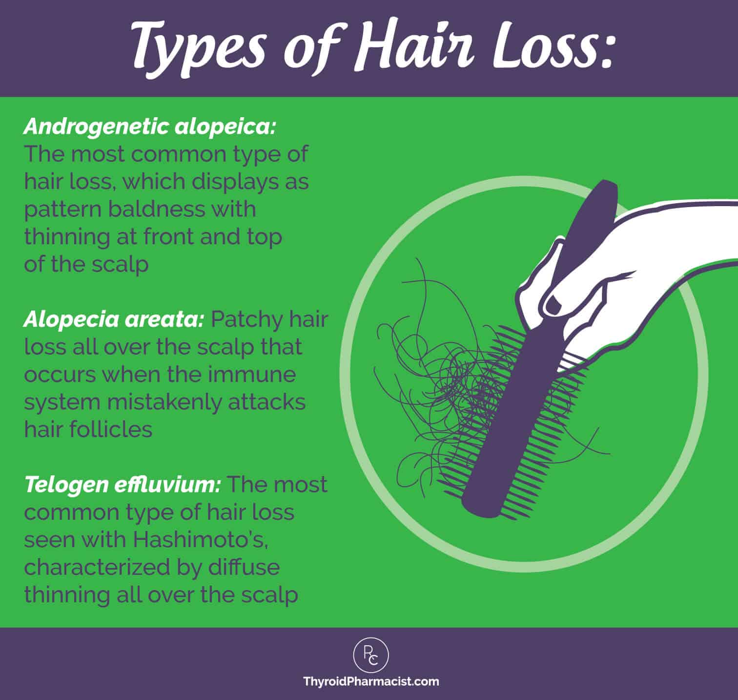 Autoimmune thyroid hair loss