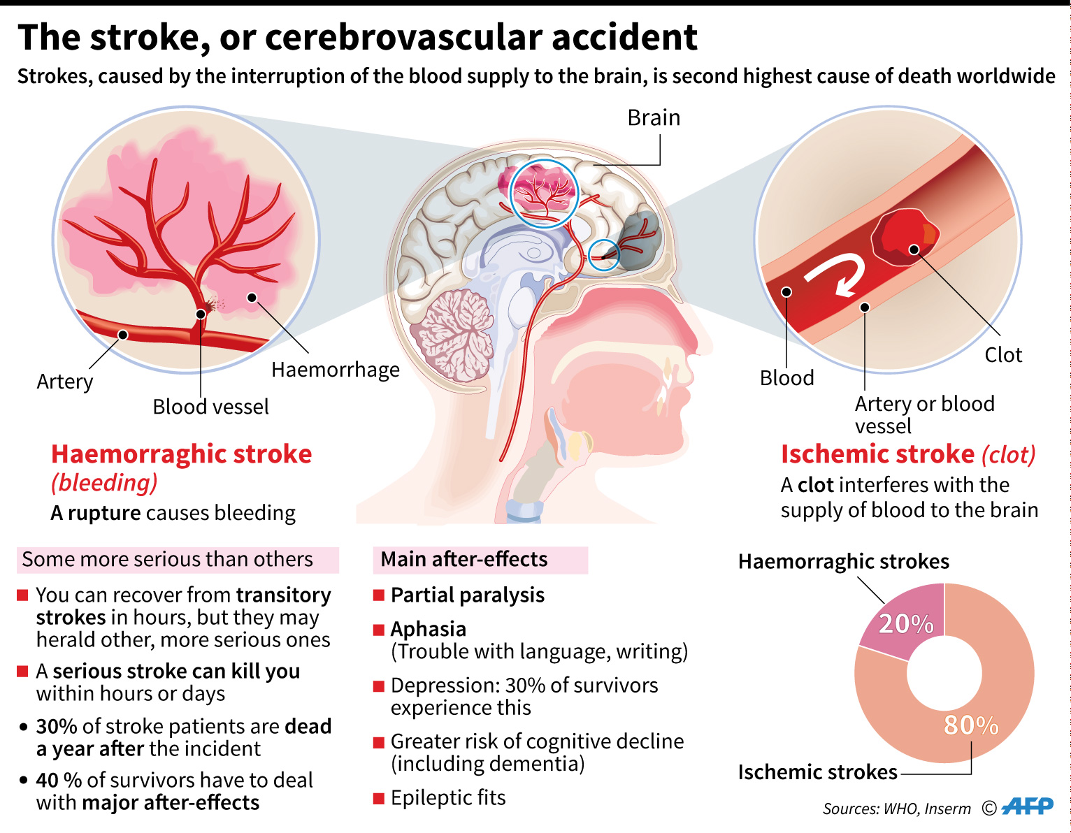 Stroke cerebrovascular accident
