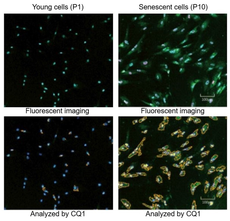 Cellular senescence microscopy