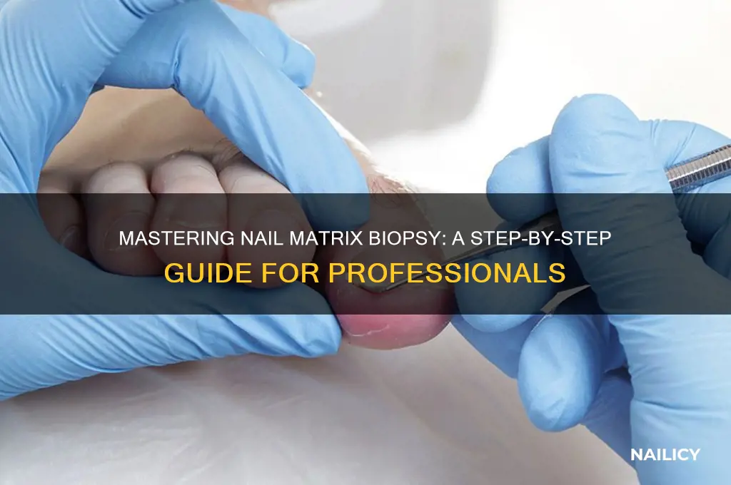 nail matrix biopsy