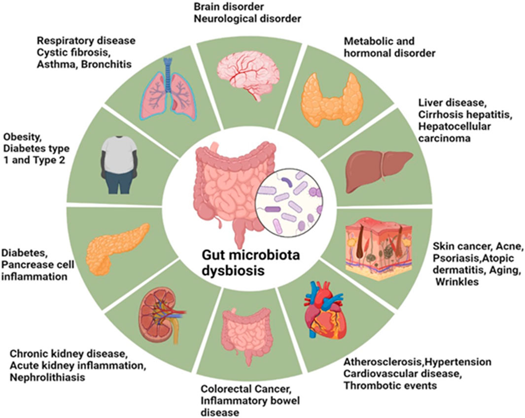 gut bacteria dysbiosis microbiome