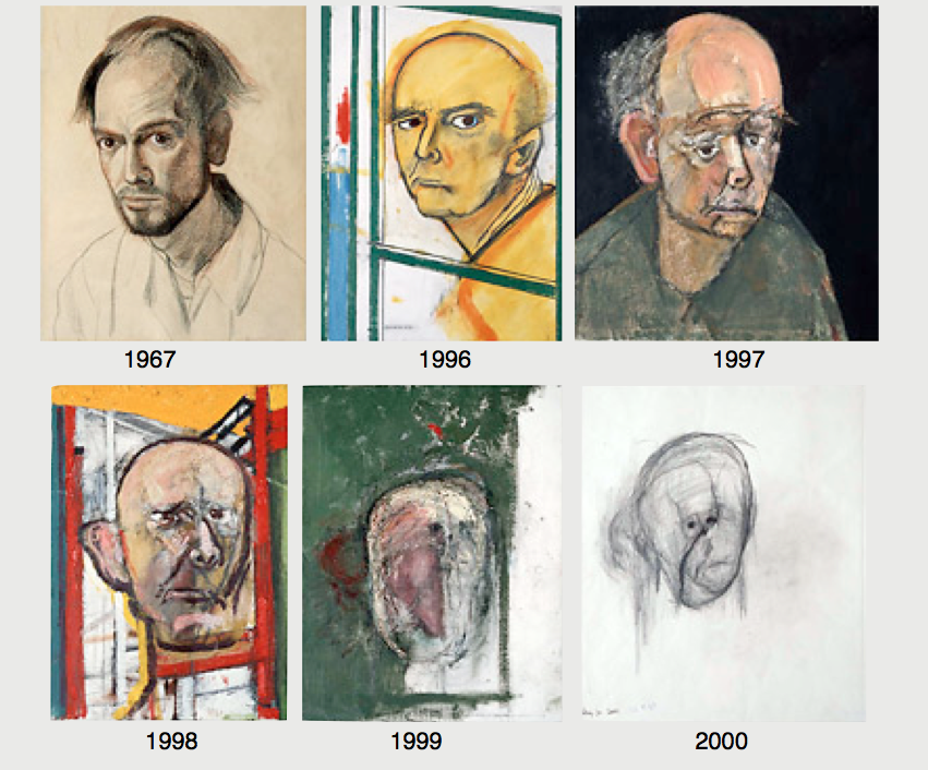dementia progression art examples