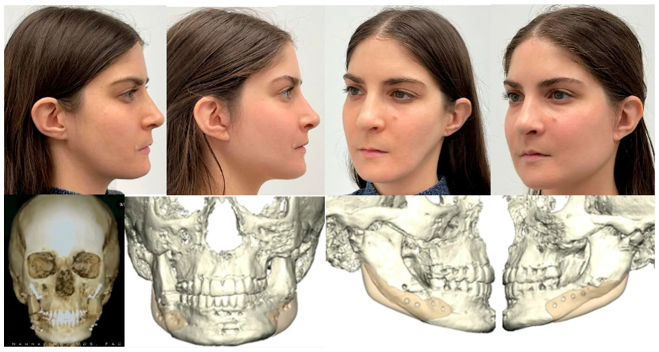 stability attractiveness after 25
