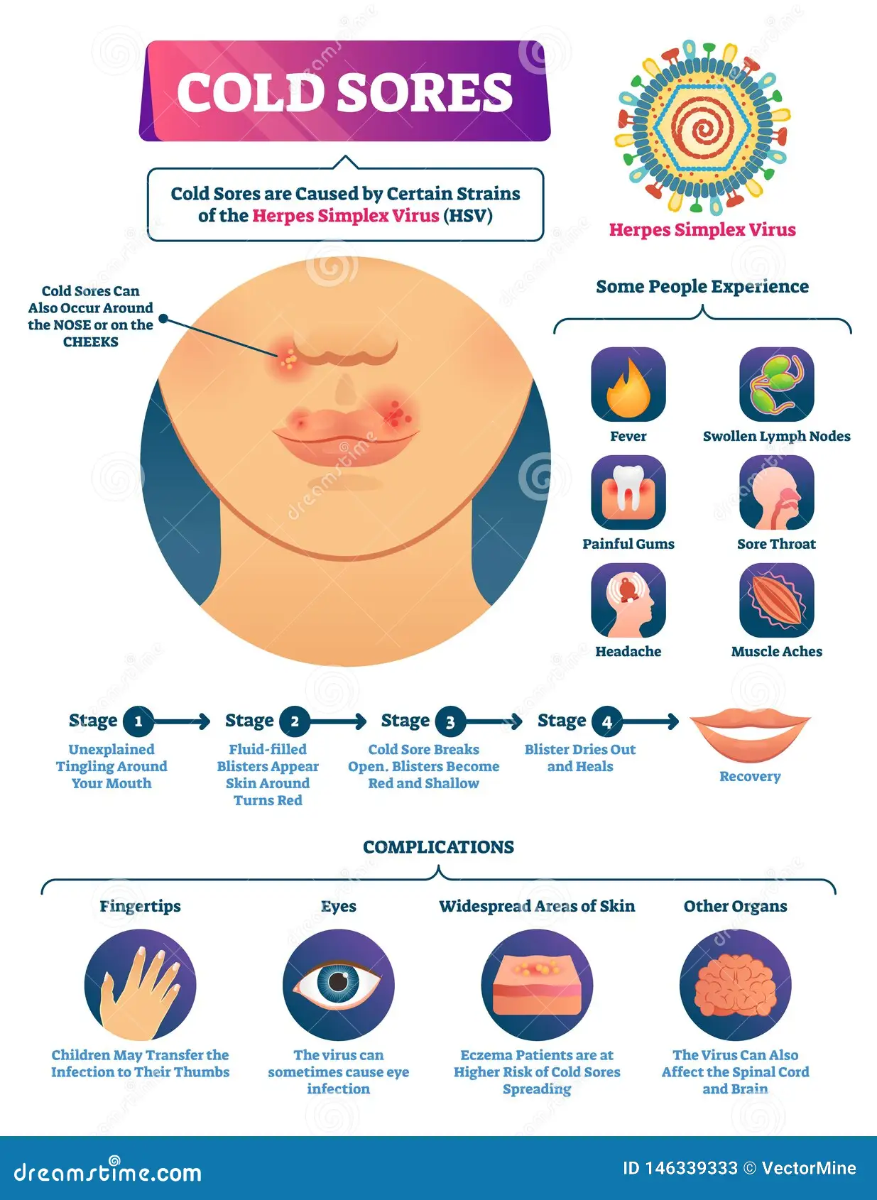 Cold sore virus transmission