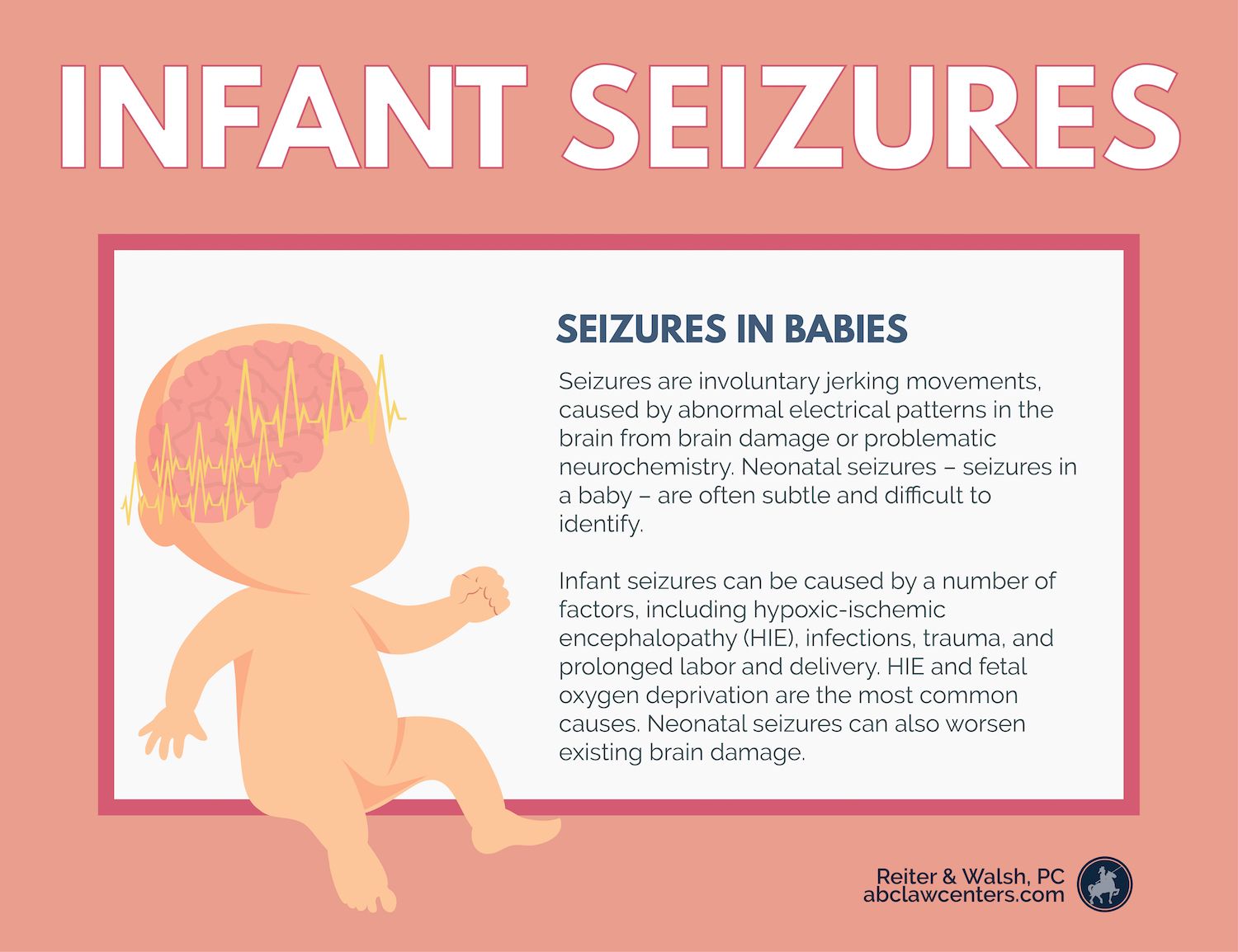 NICU baby seizures