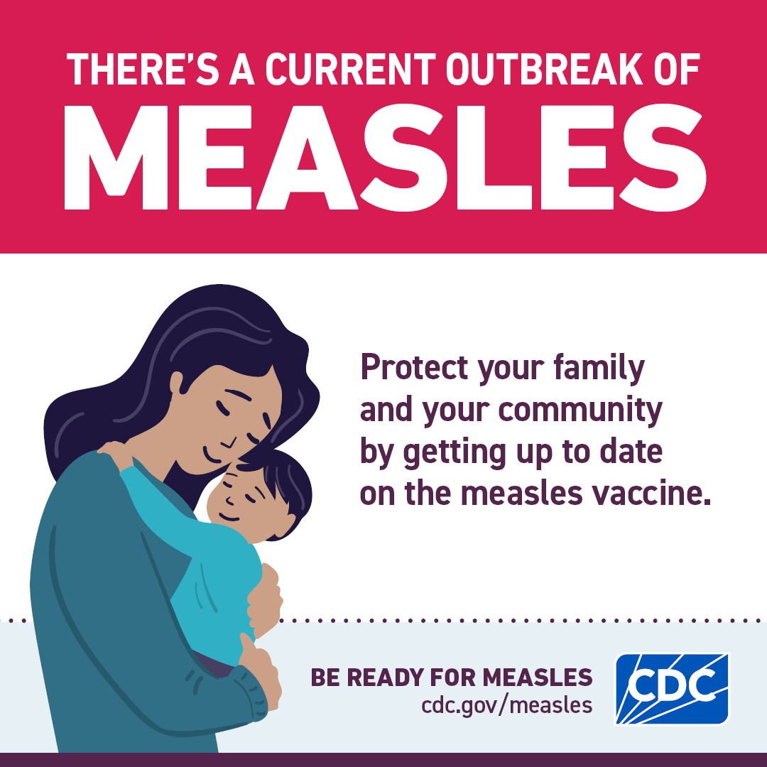 measles outbreak prevention