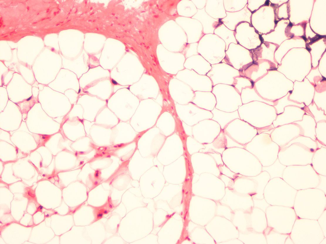 Brown adipose tissue microscopic